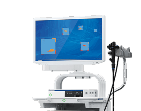Endoscopy Olympus EVIS X1