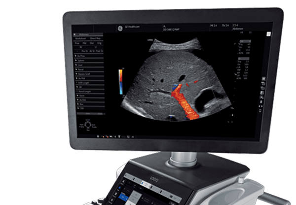 Ultrasound GE logiq E10